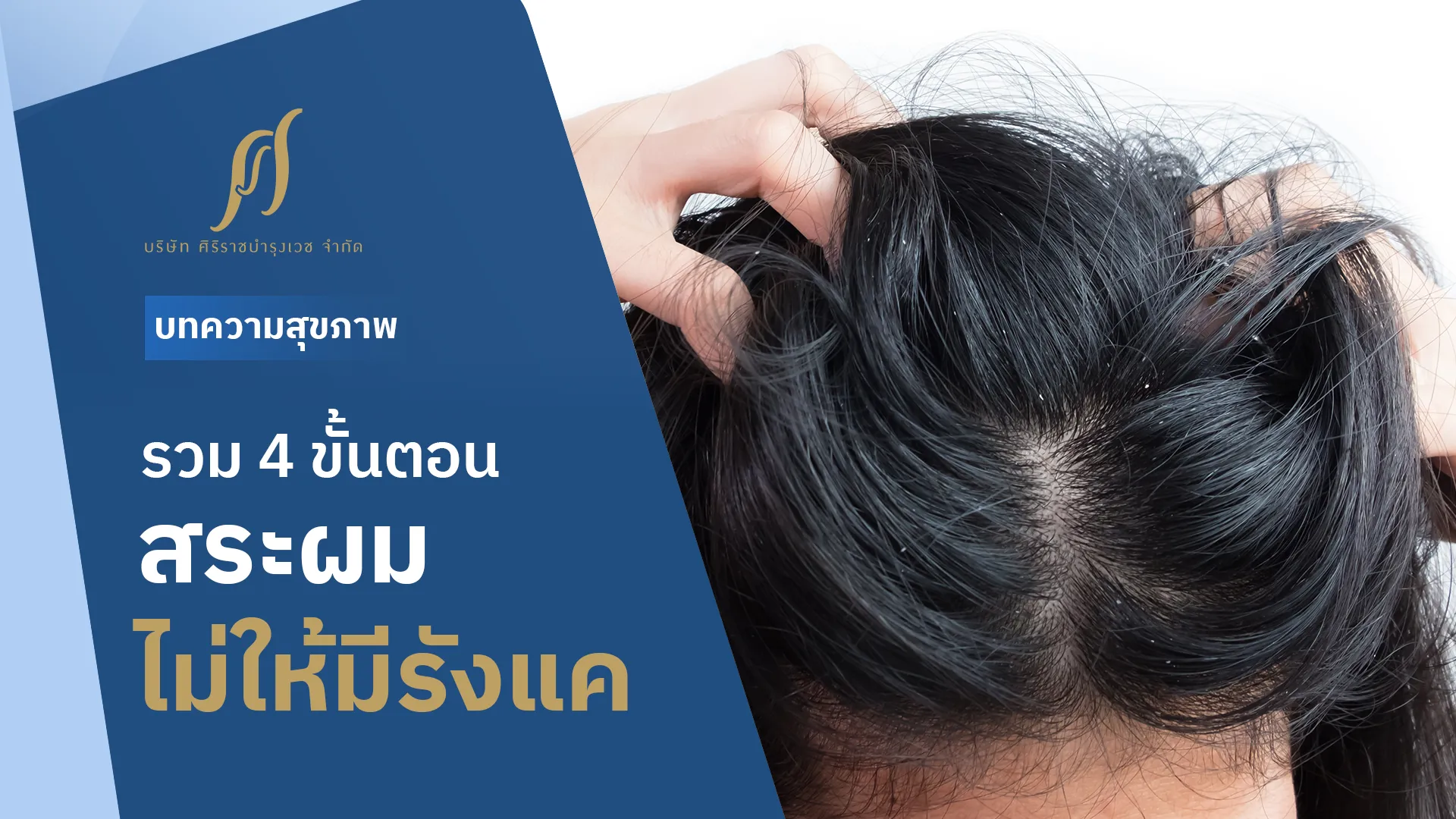 4 วิธีสระผมไม่ให้มีรังแค ทำง่ายได้ที่บ้าน เพื่อหนังศีรษะสะอาดและแข็งแรง