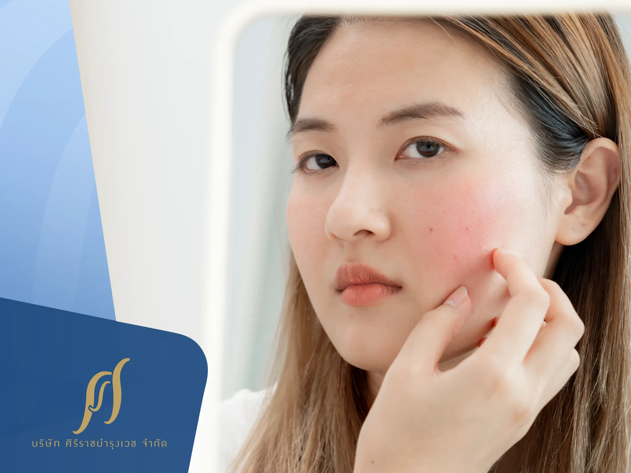 6 Steps พักหน้าเมื่อแพ้ครีมทาผิว ให้ผิวฟื้นฟูเร็วขึ้น