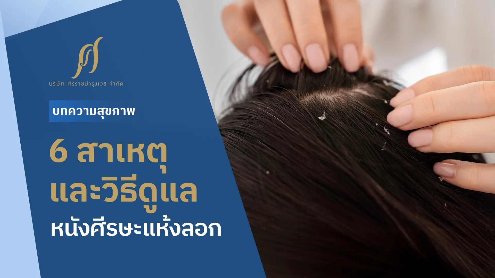 6 สาเหตุและวิธีดูแลหนังศีรษะแห้งลอกให้หายขาด