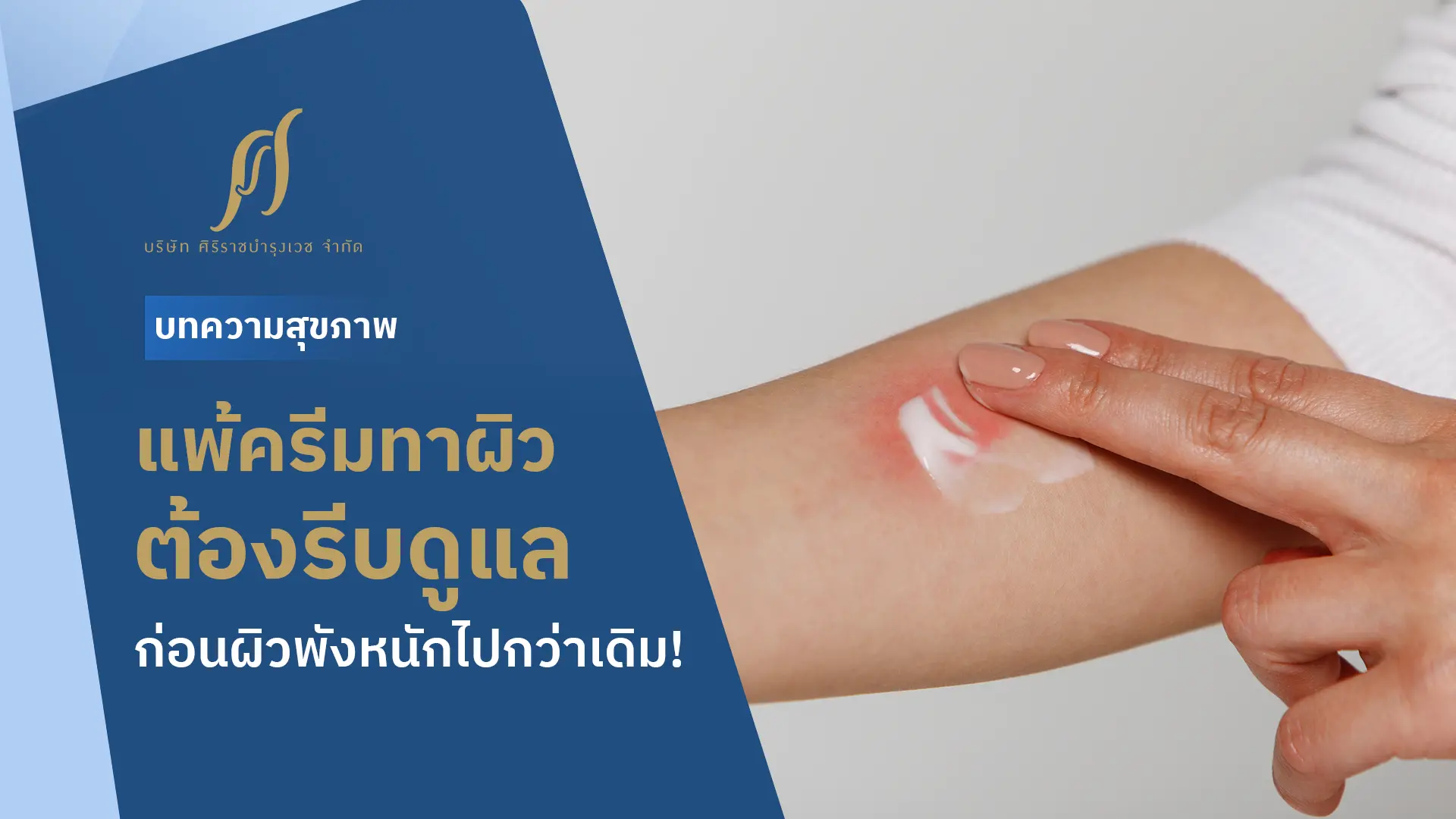 แพ้ครีมทาผิวขาวต้องรีบดูแล ก่อนผิวพังหนักไปกว่าเดิม!