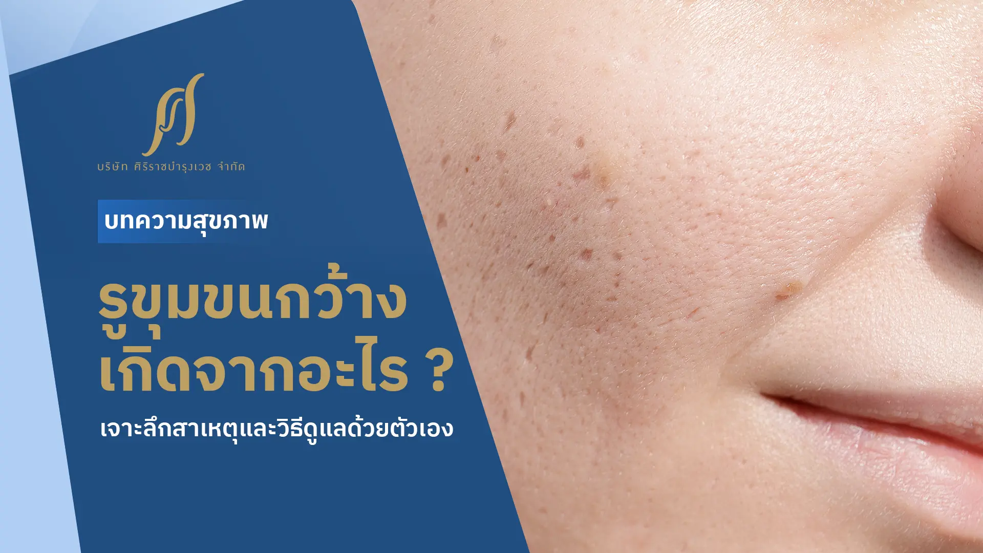 รูขุมขนกว้างเกิดจากอะไร? เจาะลึกสาเหตุและวิธีดูแลด้วยตัวเอง