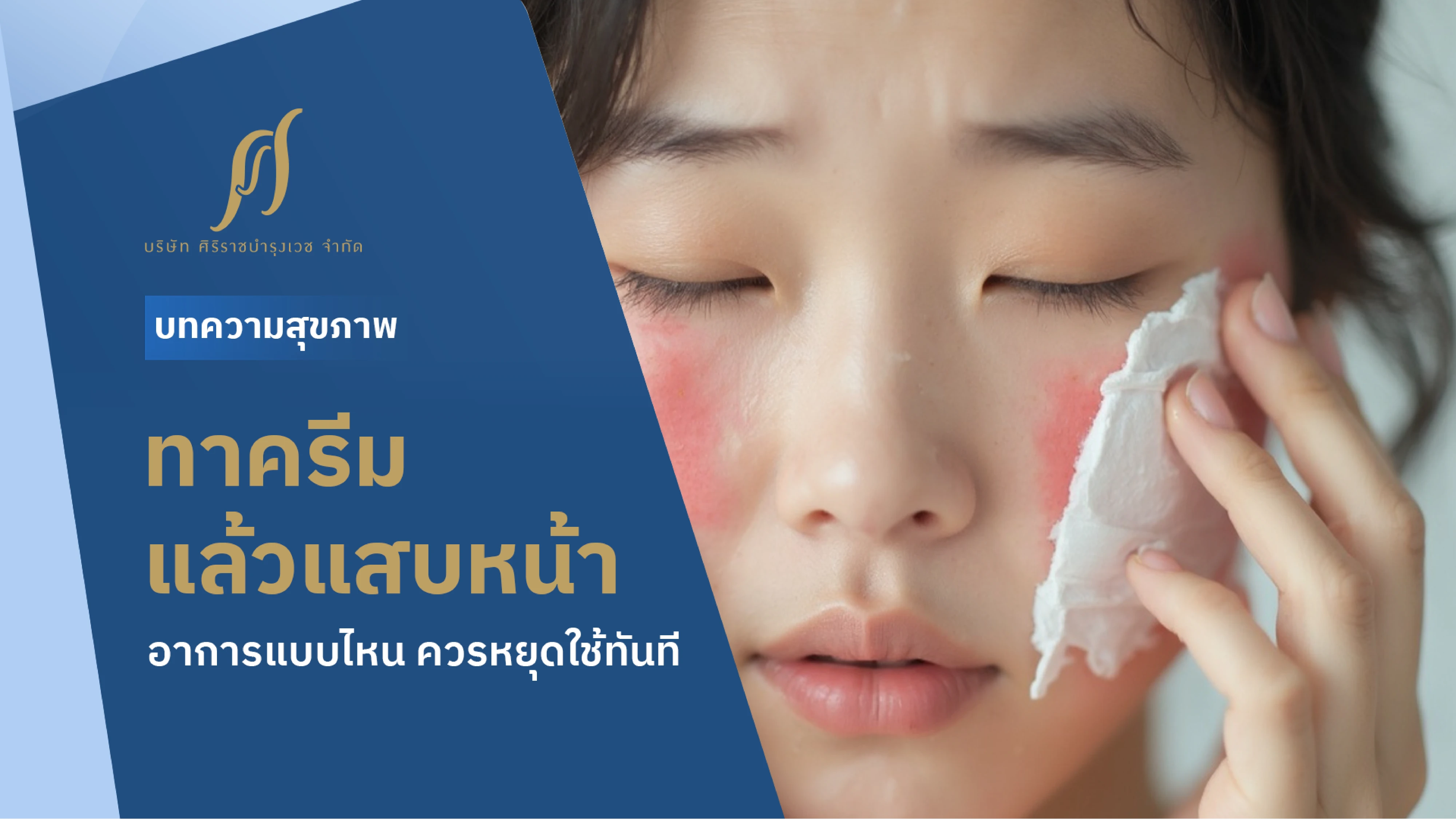 ทาครีมแล้วแสบหน้าคืออาการแพ้ใช่หรือไม่ ? รู้จักวิธีดูแลผิวที่มีอาการระคายเคือง