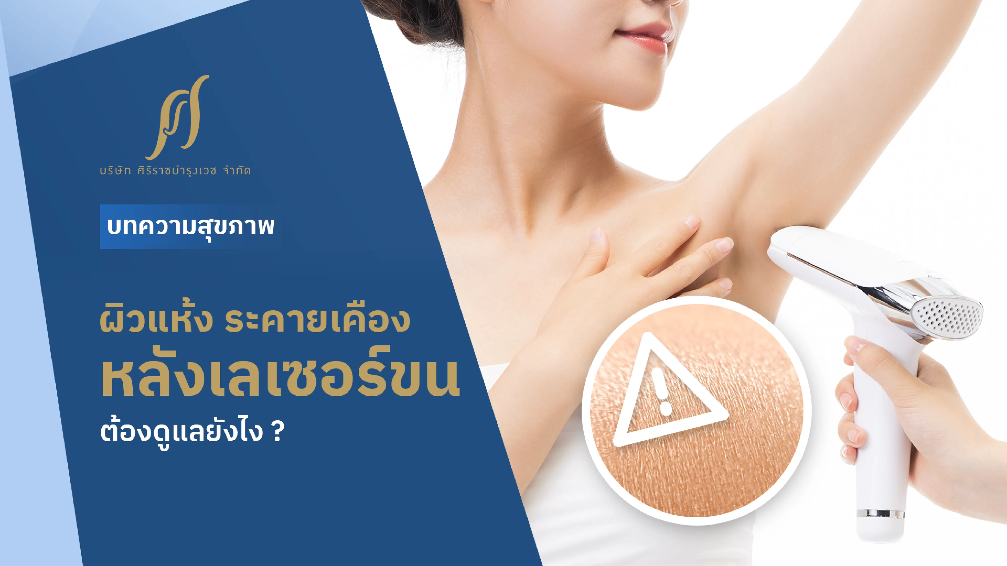 เลเซอร์ขนแล้วผิวแห้ง ฟื้นฟูง่าย ๆ ด้วยครีมทาผิวแห้งที่ช่วยให้ผิวชุ่มชื้น