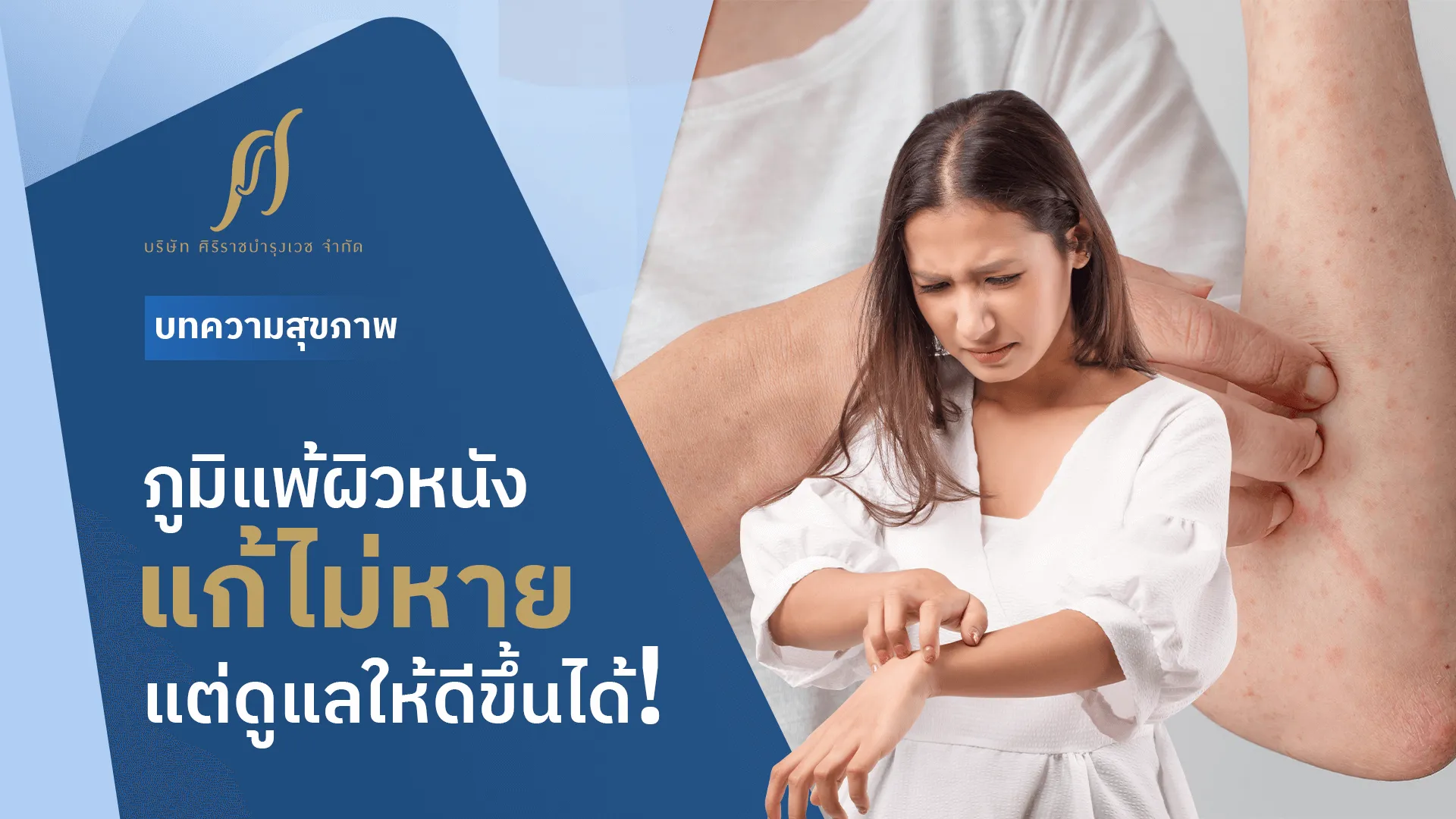 มีอาการภูมิแพ้ผิวหนัง เป็น ๆ หาย ๆ เรียนรู้สิ่งกระตุ้นใกล้ตัว พร้อมวิธีการดูแลผิว