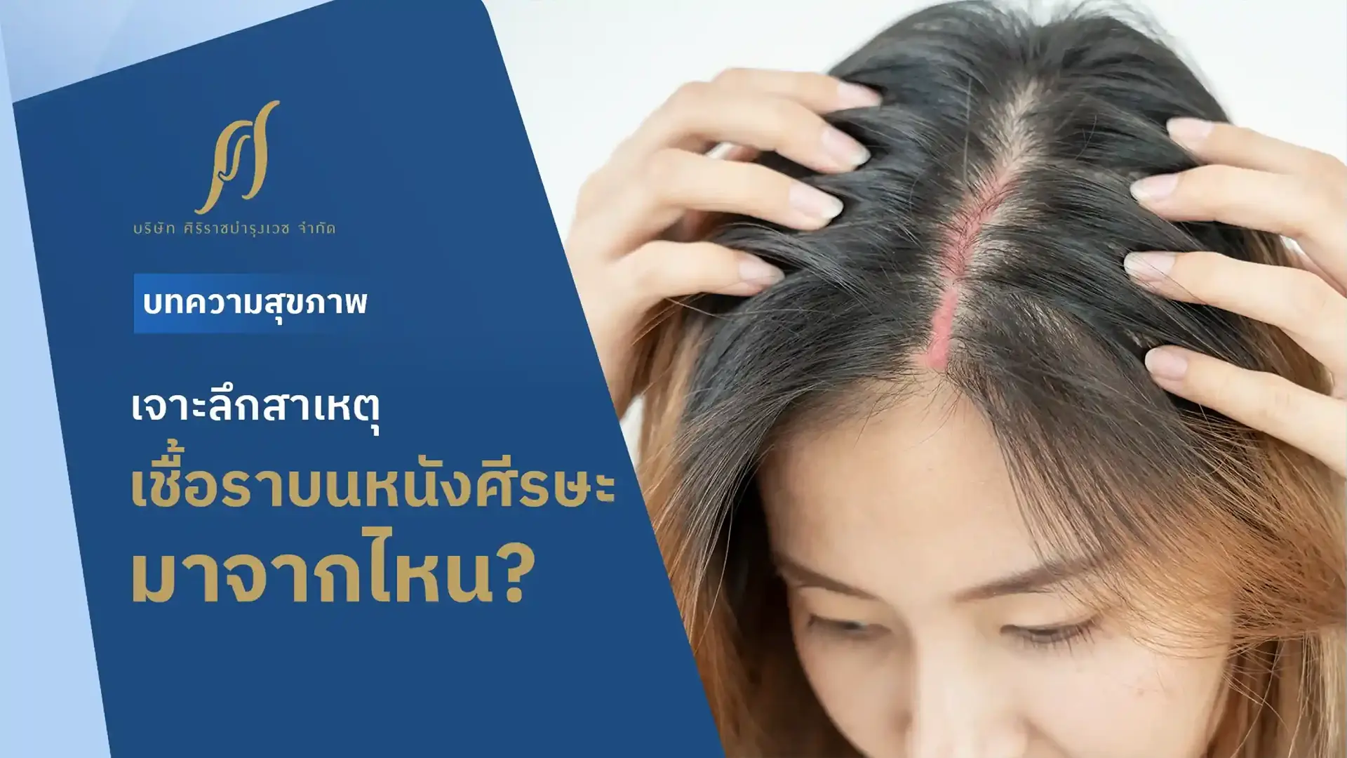 เจาะลึกสาเหตุ เชื้อราบนหนังศีรษะมาจากไหน? พร้อมแนะนำวิธีแก้ปัญหา